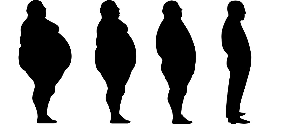 Gastric Plication